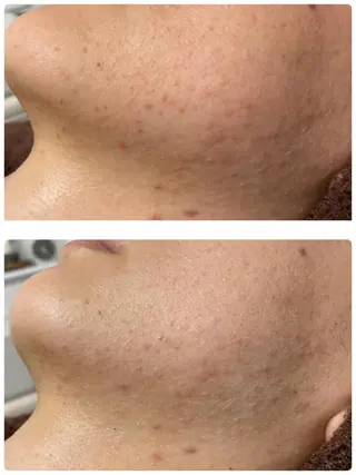 Kazrina 平松一美のエステ・リラクイメージ