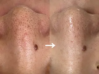 Private salon Dux所属・肌管理&nail Salon  Duxのエステ・リラクイメージ