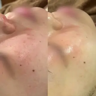 LEPUS (レプス)sasaのエステ・リラクイメージ