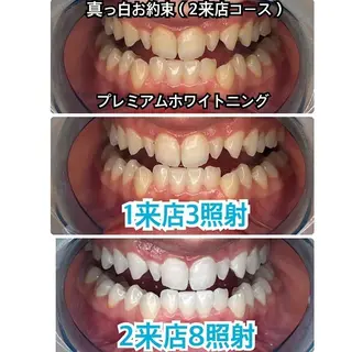 プラチナムビューティー柏所属・【歯科提携】柏ホワイ トニングスタイルのその他イメージ