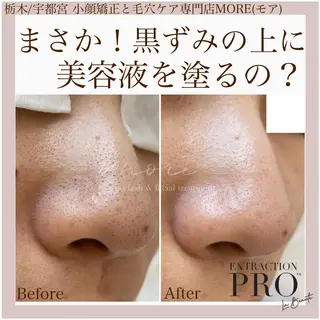 Eyelash salon MORE(モア)所属・安納 麻穂のエステ・リラクイメージ