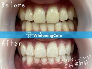 ホワイトニングカフェ原宿店所属・ホワイトニングカフェ 原宿店のエステ・リラクイメージ