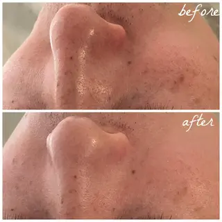 メンズ メナード岐阜市茜部 杉浦のエステ・リラクイメージ