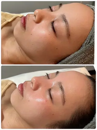 、 、‪‪のエステ・リラクイメージ