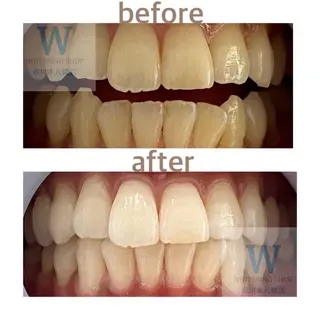 ホワイトニング ショップ本八幡店のエステ・リラクイメージ