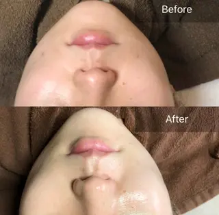 ALIA Scintiller  アリアサンティエ所属・齋藤 祐里耶のエステ・リラクイメージ