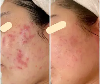 小顔・肌質改善 espoir 心斎橋のエステ・リラクイメージ