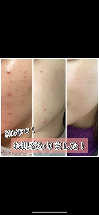 Esthe salon Blanche(エステサロンブランシュ)所属・小顔リフトアップ 美肌改善専門店のエステ・リラクイメージ