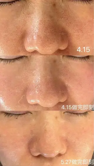 ショート aliaハイフ&水光ジェットサロン所属・aliaハーブ水光店 エステティシャン募集のエステ・リラクイメージ