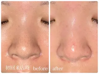 salonＮ所属・24時間営業 ハーブ/毛穴洗浄のエステ・リラクイメージ