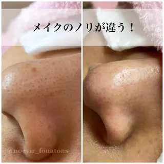 フェイシャルエステFOUATONS*所属・フェイシャルエステ ふわっとんのエステ・リラクイメージ