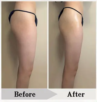 BAUM坂戸 ヘッドスパのエステ・リラクイメージ