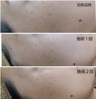 シミケア専門店 HAQUAのその他イメージ