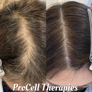 Blooming所属・LOUISE. ／肌質・頭皮のエステ・リラクイメージ