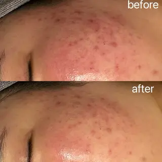 小顔＆まつ毛サロン AKANE❤️のエステ・リラクイメージ