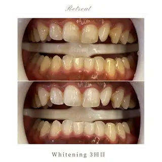 Retreatリトリート所属・歯科医院提携 Retreatのエステ・リラクイメージ