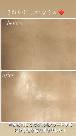 美肌脱毛fuu okinawa所属・宜野湾美肌脱毛fuu okinawaタイラのエステ・リラクイメージ