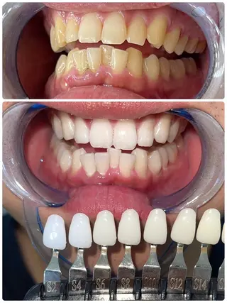 セルフホワイトニング エクシア徳島店マユのその他イメージ