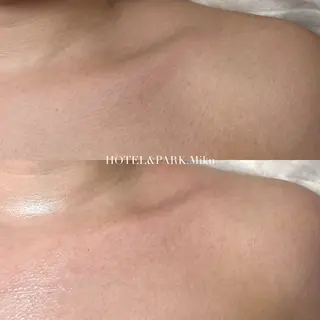 HOTEL&PARK Mikuワックス脱毛のエステ・リラクイメージ