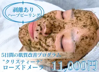 BestBelleꕤ 大阪福島/肌質改善のエステ・リラクイメージ