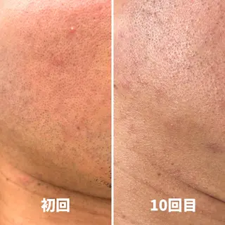 salon Removeのエステ・リラクイメージ