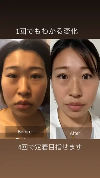 小顔専門 ヘッドスパ【jiu】のエステ・リラクイメージ