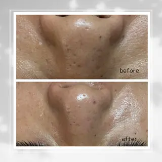 肌質改善フェイシャルCLEAR栄生/リンパ/毛穴/シミケア所属・井戸 麻衣のエステ・リラクイメージ