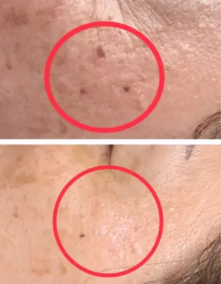 LUZ所属・LUZ ルースの眉毛・アイブロウイメージ