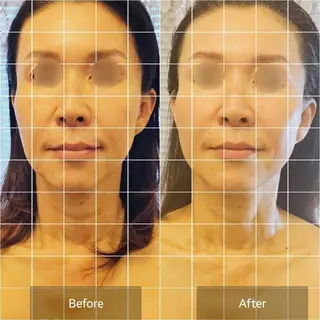 小顔・美肌ケア専門 Diva北浜のエステ・リラクイメージ