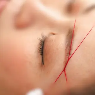 【産毛・眉毛ケア＆肌質改善サロン】＊BiBi＊beautysalon所属・眉･産毛専門BiBi 糸脱毛スレッティングのエステ・リラクイメージ