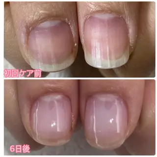 ネイル 大人可愛い高技術ネイ ル♡美爪A nailのネイルデザイン