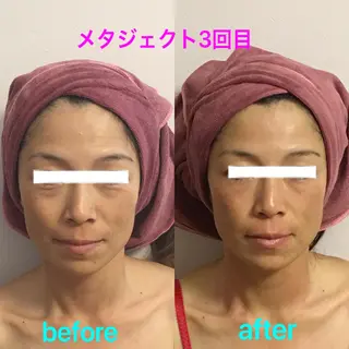 氣楽所属・松下 さゆりのエステ・リラクイメージ