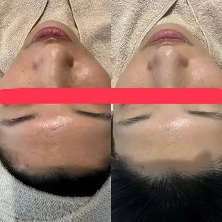 mili mili beauty salon所属・mili mili 岡本のエステ・リラクイメージ