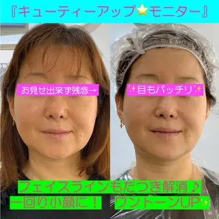 小顔美肌&痩身ｻﾛﾝ My Timeのエステ・リラクイメージ