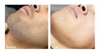 めぞんどぼーて ATSUMIのマツエク・マツパデザイン