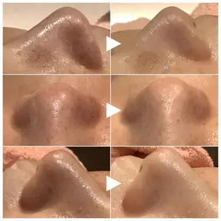 脱毛&エステサロン JIGGLY武蔵小山のエステ・リラクイメージ