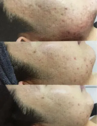 ALIA Scintiller  アリアサンティエ所属・齋藤 祐里耶のエステ・リラクイメージ