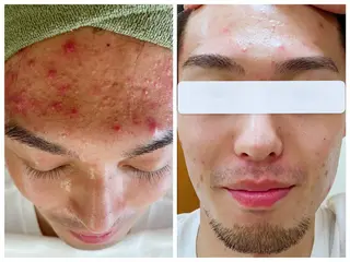 Brand byme 上野店のエステ・リラクイメージ