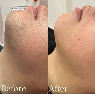 Amaryllis所属・あ あのエステ・リラクイメージ