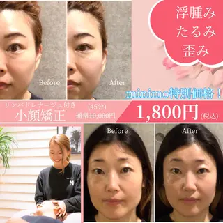 恵比寿/小顔/矯正 美容整体師⭐︎Aiのエステ・リラクイメージ