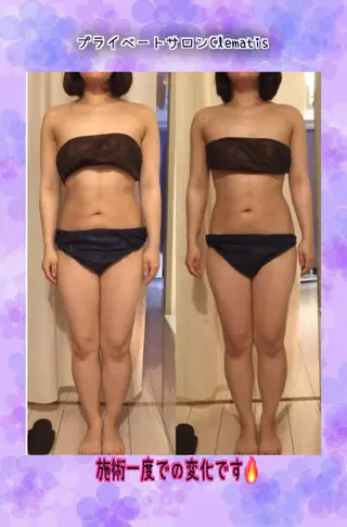 ショート カラー パーマ ヘアアレンジ メンズ キッズ ネイル マツエク・マツパ 強圧オールハンド痩身&黄土よもぎ蒸しプライベートサロンClematis池袋所属・強圧オールハンド痩身 片野のエステ・リラクイメージ