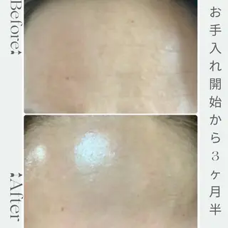 Luce所属・Luce Shokoのエステ・リラクイメージ