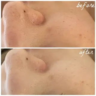 メンズ メナード岐阜市茜部 杉浦のエステ・リラクイメージ