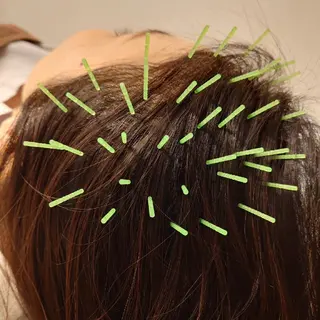 北梅田美容鍼灸院所属・美容鍼マイスター 川村　淳のエステ・リラクイメージ