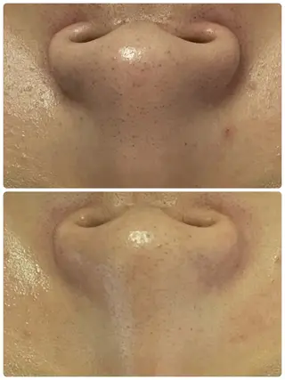 Salon Rion所属・Rion 野々村のエステ・リラクイメージ