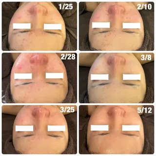 LILY E所属・LILY Eのエステ・リラクイメージ