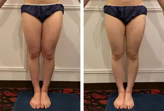 ハイパーナイフEX 小顔×痩身ケアのエステ・リラクイメージ