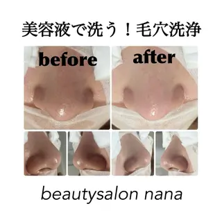beauty salon nana所属・beauty salon nanaのエステ・リラクイメージ