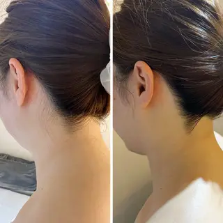 うなじ脱毛/美肌脱毛 LABELのエステ・リラクイメージ