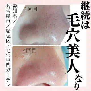 プライベートサロン Gardenのエステ・リラクイメージ